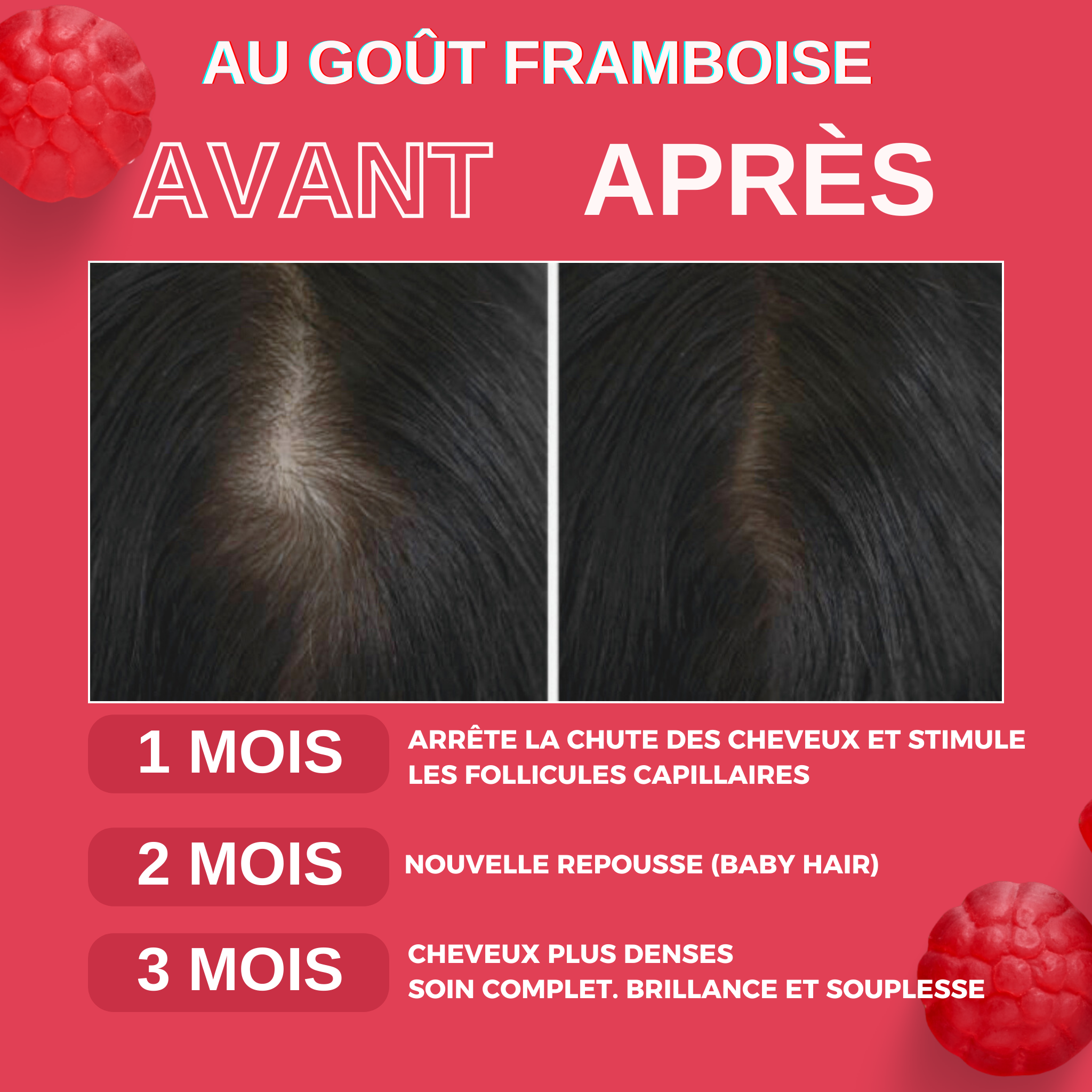 Gummies Cheveux & Ongles
